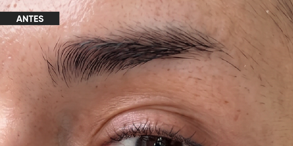 Antes